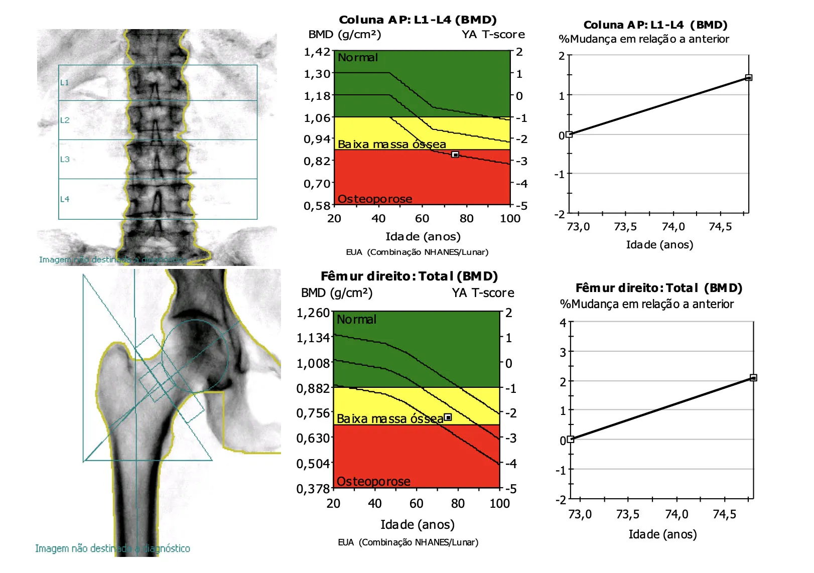O melhor médico para tratamento de osteoporose