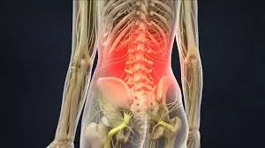 Médico especialista em dor na lombar