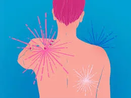 Reumatologista que trata fibromialgia