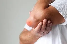 O melhor reumatologista para tratamento de bursite